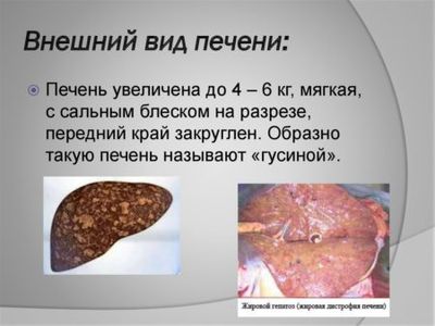 Жировая дистрофия