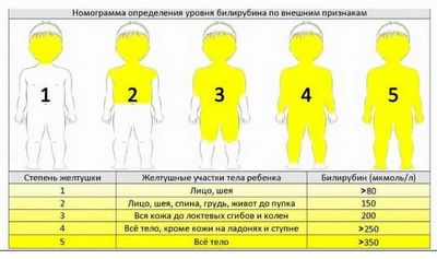 основные симптомы желтухи у детей