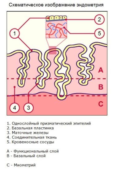 гиперплазия эндометрия лечение после выскабливания