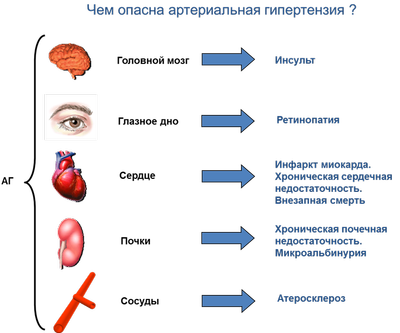 Уникальное лекарство от повышенного давления - Гипертониум