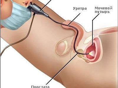железы предстательной железы гистология