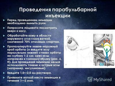 Парабульбарная инъекция