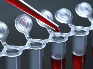 Изучаем анализ крови hbs ag: описание и расшифровка антигена