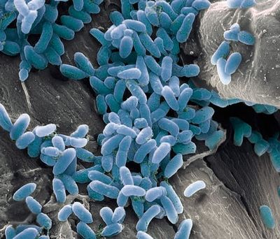 Pseudomonas aeruginosa