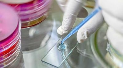 ифа 4 поколения на вич через 4 недели