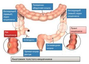 Причины возникновения болезни