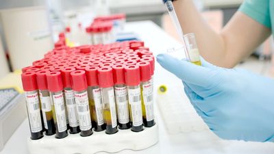 Каротиновая желтуха диагностика