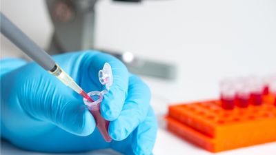 Отличие количественного и качественного анализа на гепатит