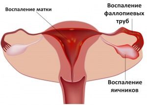 Самые распространенные причины возникновения заболевания