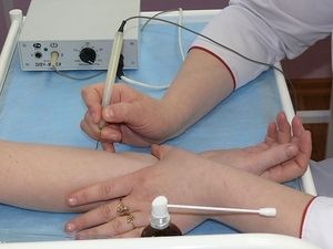 Почему возникают кондиломы