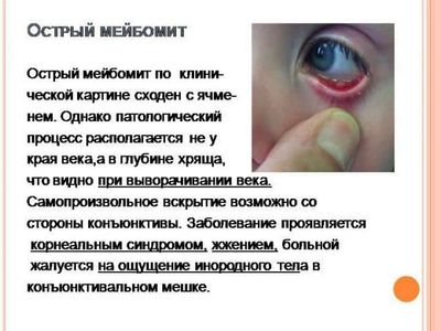 Отек век по утрам: в чем причина проблемы?