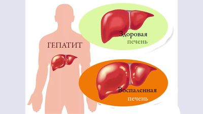 Печеночно-клеточная недостаточность причины