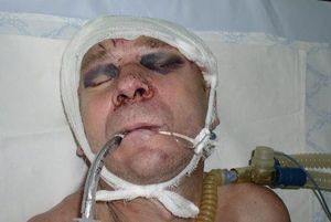 повязка на голове