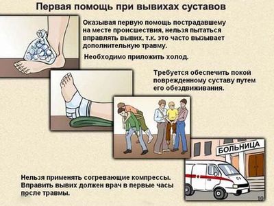 Как оказать первую помощь при вывихах