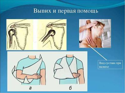 травма плечевого сустава