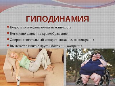 Гиподинамия