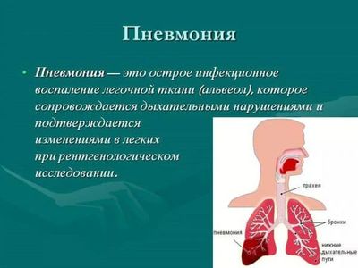 Признаки пневмонии у ребенка без температуры, но с кашлем - симптомы