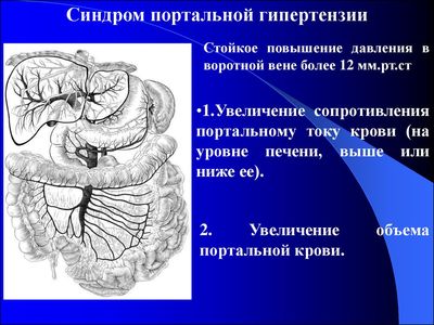 Синдром ПГ
