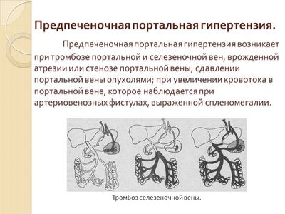 Предпеченочная ПГ
