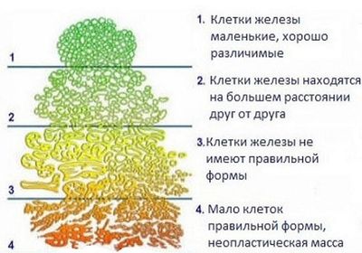 Степень злокачественности
