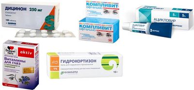 Медикаменты для лечения ретинитов