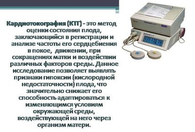 Кардиотокография