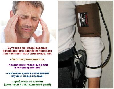 Суточный мониторинг давления