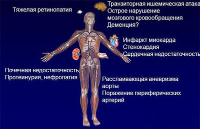 осложнения аг