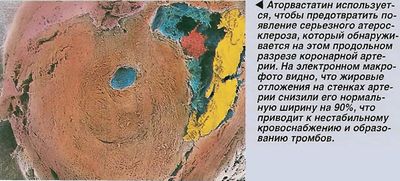 Действие аторваститина