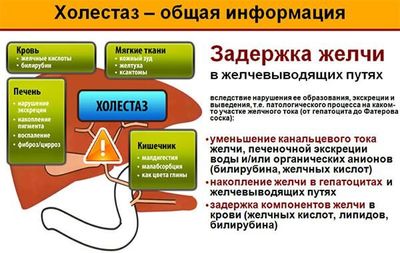 Холестаз