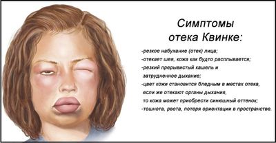 Ангионевротический отек