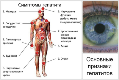 Гепатит