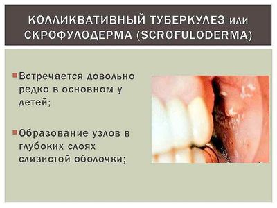 скрофулодерма