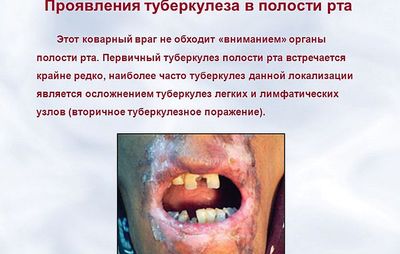 проявления