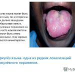 на языке
