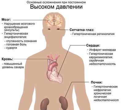 Осложнения гипертонической болезни